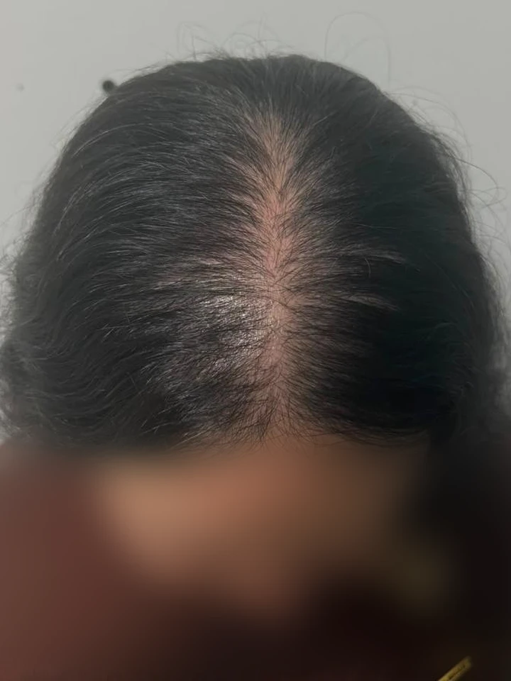 Depois Tratamento Clínico Feminino